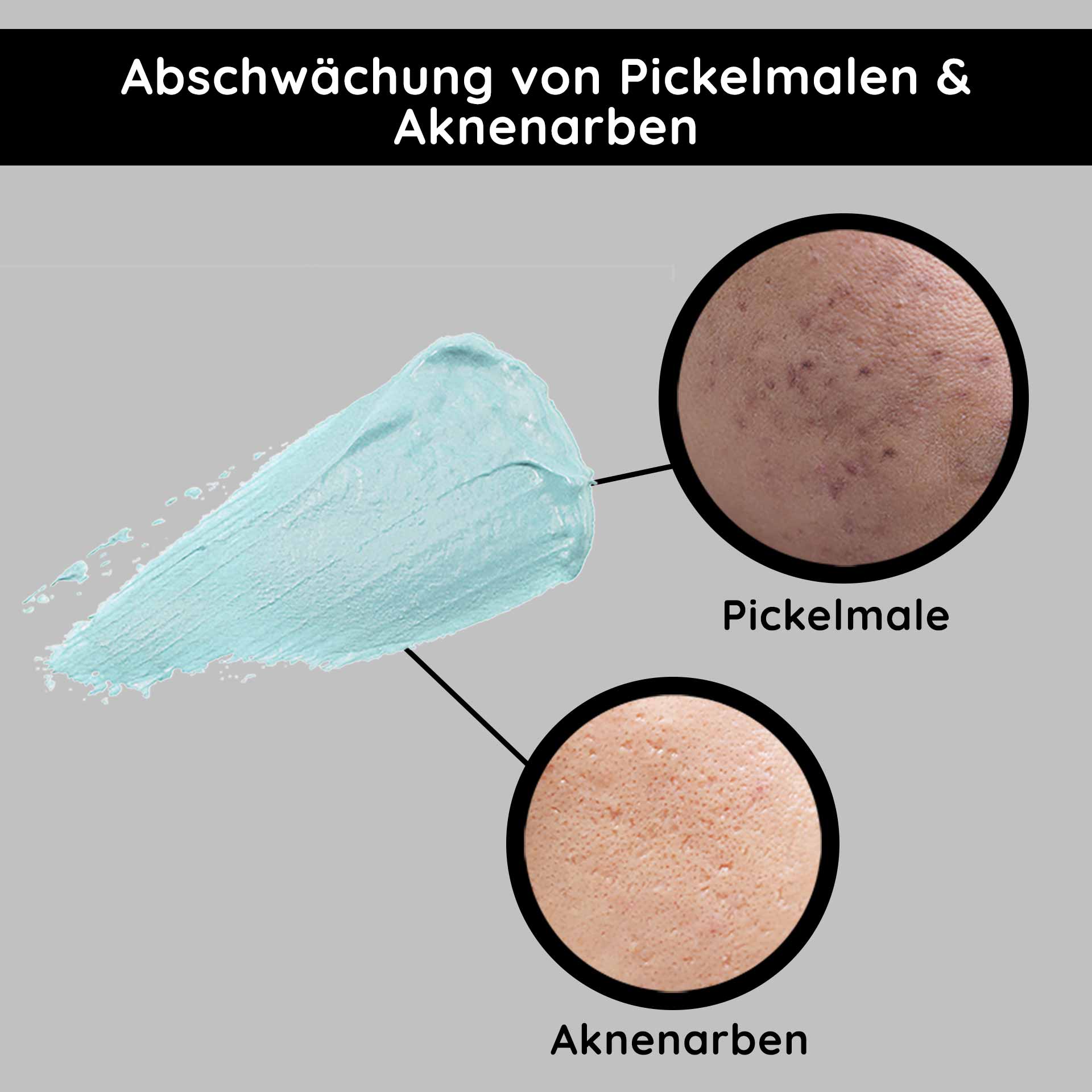 O2 丰润霜 200 毫升 丰润芳香型 Abschwächung von Pickelmalen und Aknenarben mit blauer Creme, Vergleich von Hauttexturen für Hautpflegeprodukte.